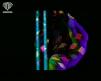 +18 Ftv - Crazy Horse