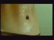 Fazla Diet Yapma