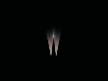Anestezi  [ Awake ] 2007 1-15